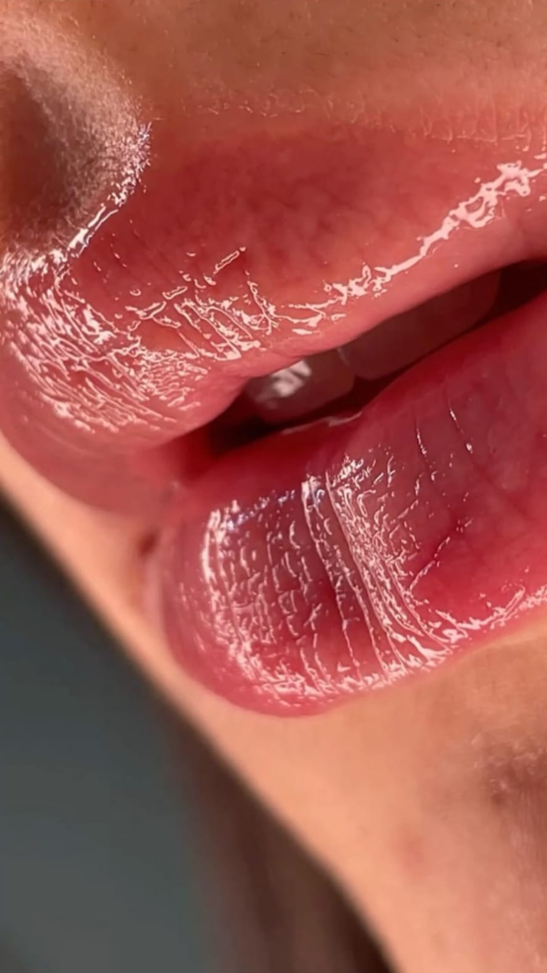Regenere Lips